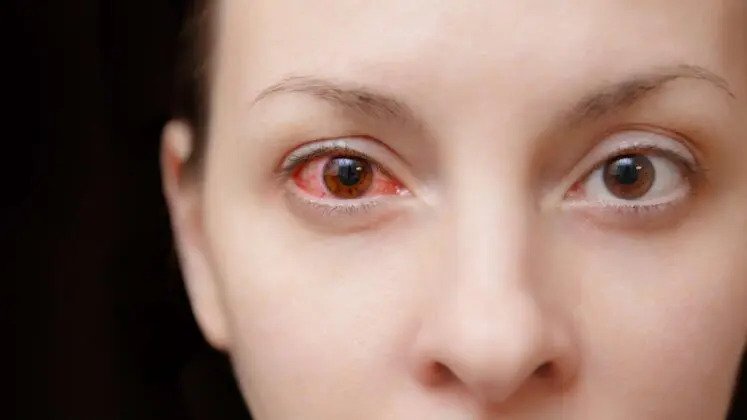 Eye Disease Treatment in Delhi